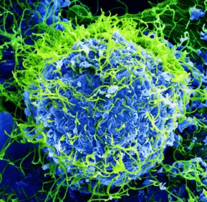 Ebola-Ausbruch im Kongo - Höchste Todeszahl in der Geschichte